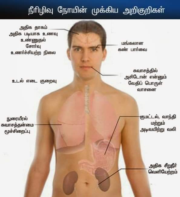 சர்க்கரை நோய் உள்ளவர்கள் கொரோனா நோய் தடுப்புக்கு என்ன செய்ய வேண்டும் ??